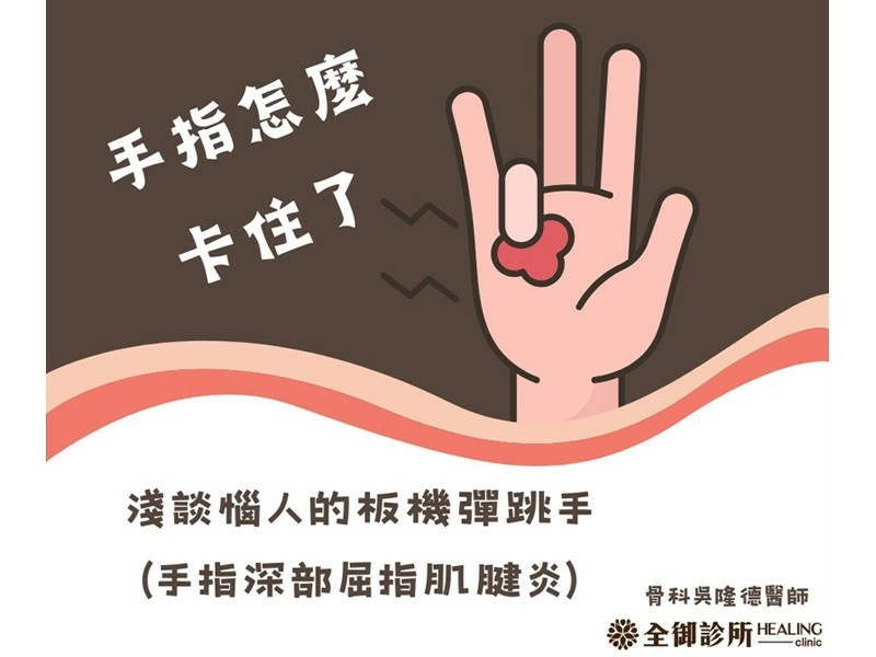 淺談惱人的板機彈跳手(手指深部屈指肌腱炎)