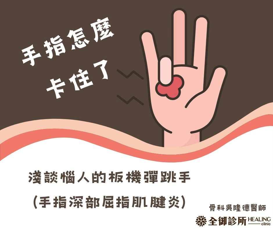 淺談惱人的板機彈跳手(手指深部屈指肌腱炎) 淺談惱人的板機彈跳手(手指深部屈指肌腱炎)