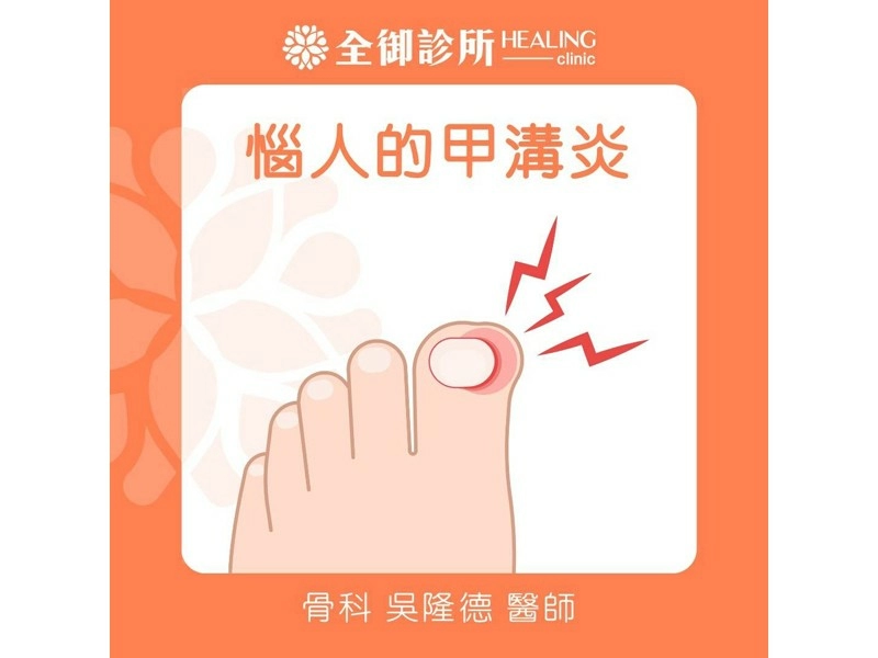 惱人的甲溝炎！甲溝炎的致病原因