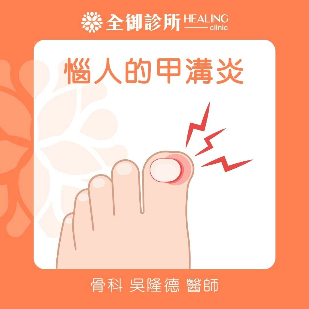 惱人的甲溝炎!甲溝炎的致病原因 惱人的甲溝炎!甲溝炎的致病原因